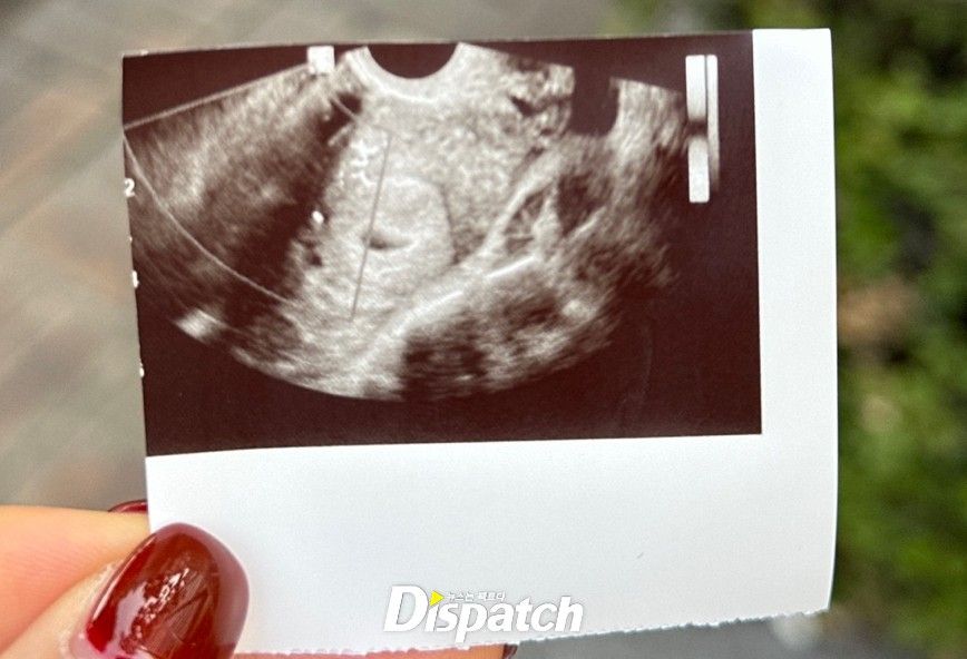 Son Heung min Dispatch 