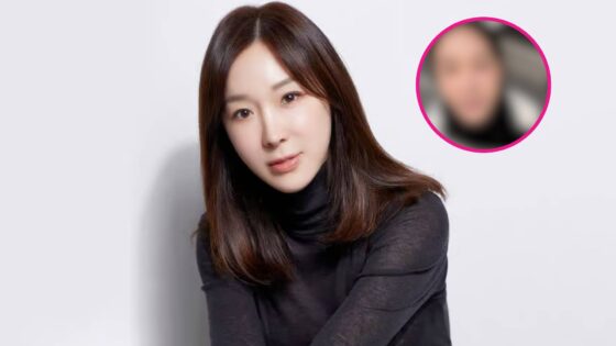 lee-ji-hye-muestra-su-rostro-tras-la-cirugia-de-reduccion-del-surco-nasolabial-unniepop