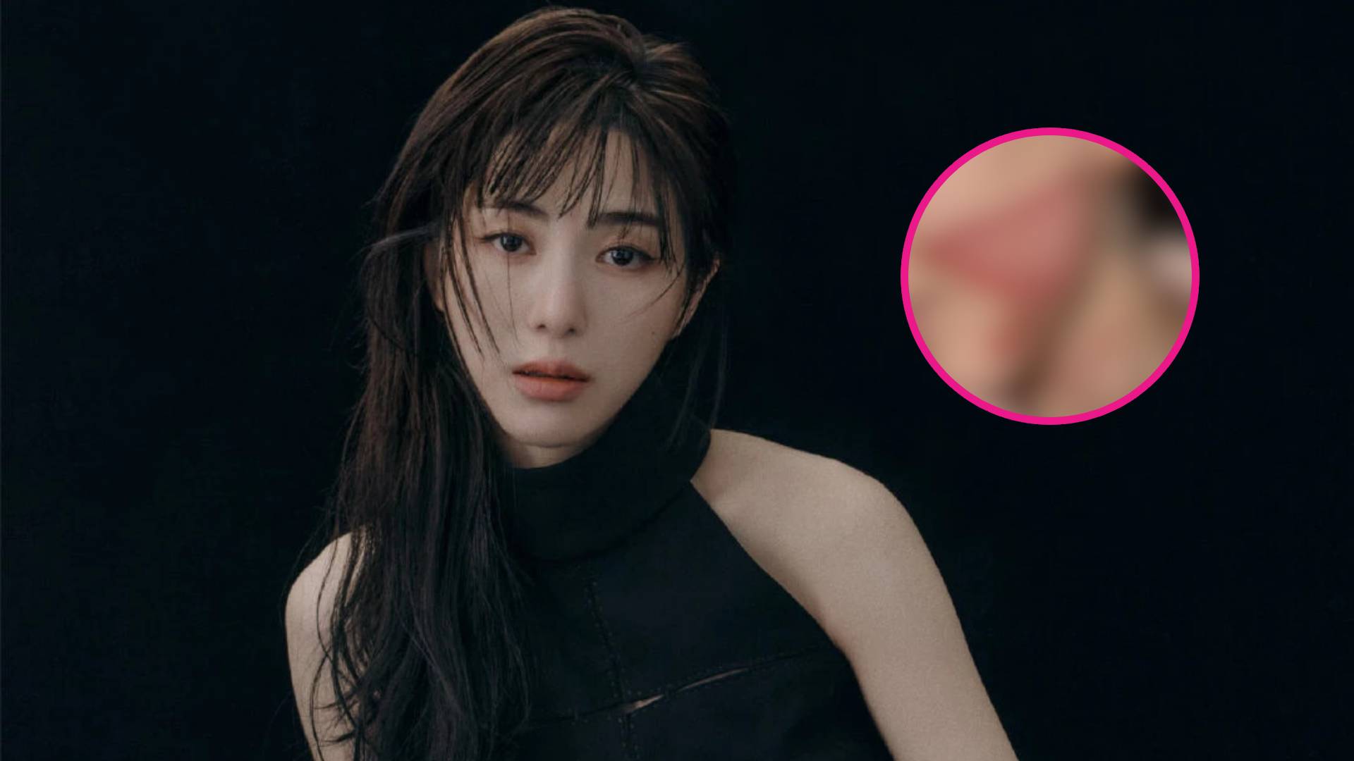 kwon-mina-ex-aoa-revela-quemaduras-tras-un-procedimiento-estetico-unniepop